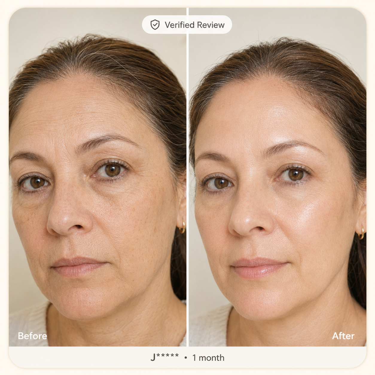Before and after skincare result review photo