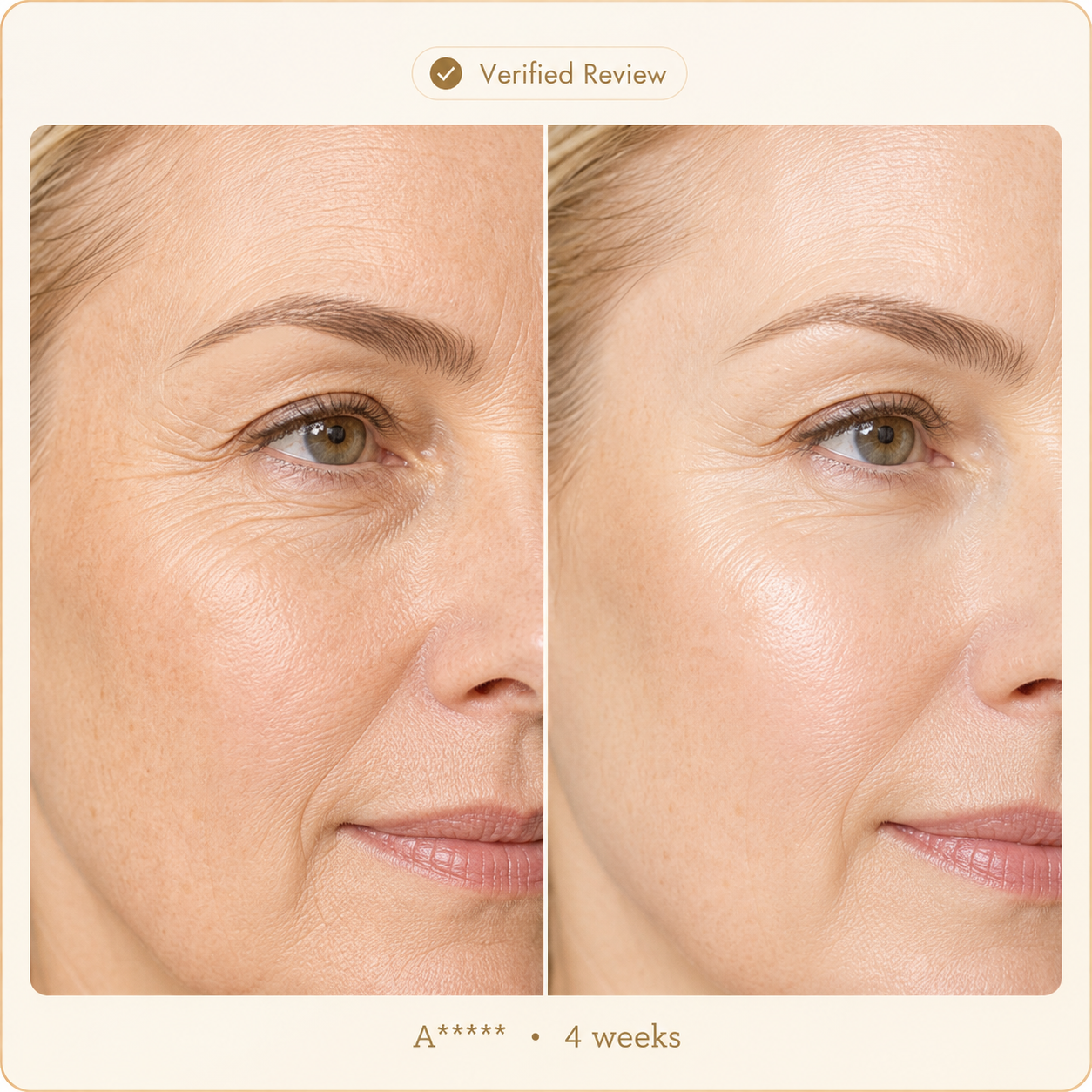 Before and after skincare result review photo